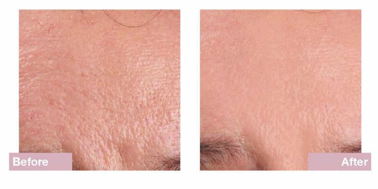 Dermatude Andlitsmeðferð Dharma Snyrtistofa 22