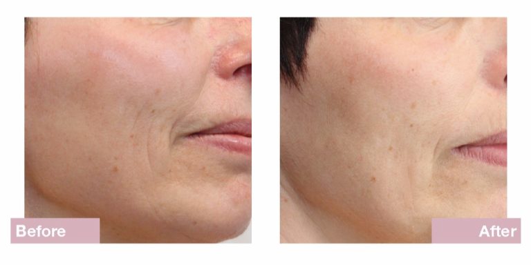 Dermatude Andlitsmeðferð Dharma Snyrtistofa 27