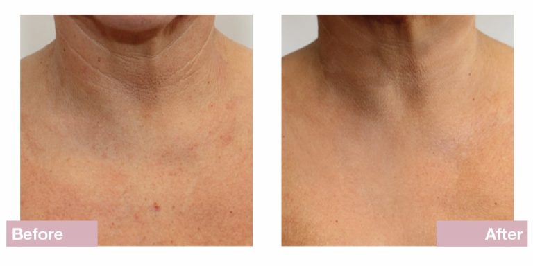 Dermatude Andlitsmeðferð Dharma Snyrtistofa 44